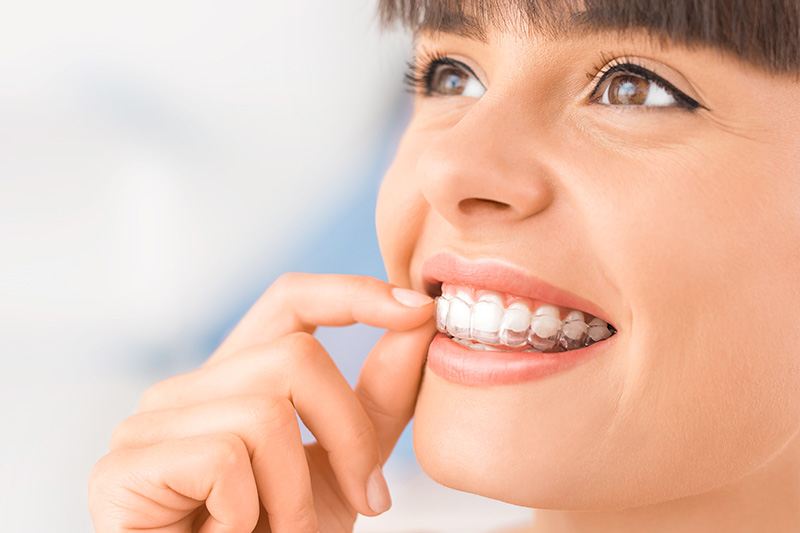 Orthodontics in Clemmons